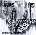 Vulnus : Exposed to the Appalling